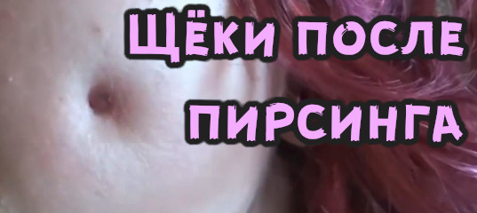 Щеки после пирсинга